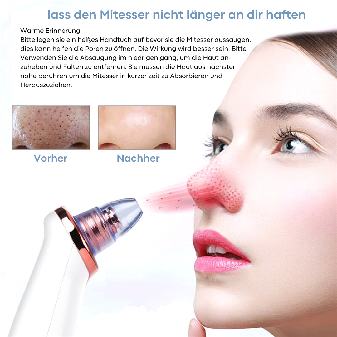 Mitesser Remover